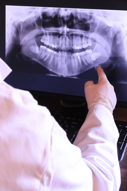 Best Emergency Dentist for Lost Fillings or Crowns in Echelon, NJ