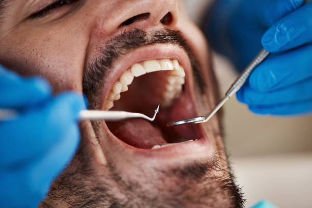 Best Emergency Dentist for Knocked-Out Tooth in Echelon, NJ