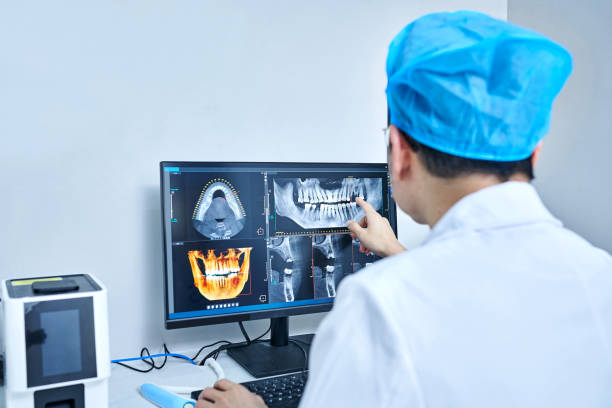 Best Emergency Dental Care for Abscessed Tooth in Echelon, NJ